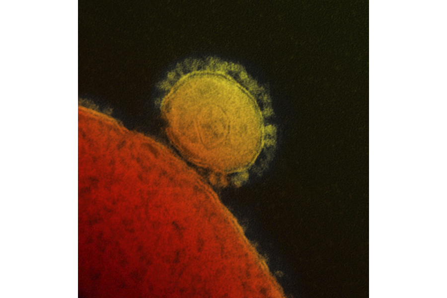 Transmission electron micrograph of Middle East respiratory syndrome coronavirus