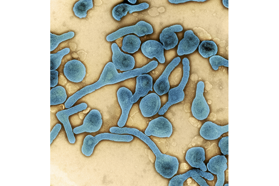 Colorized transmission electron micrograph of Marburg virus part