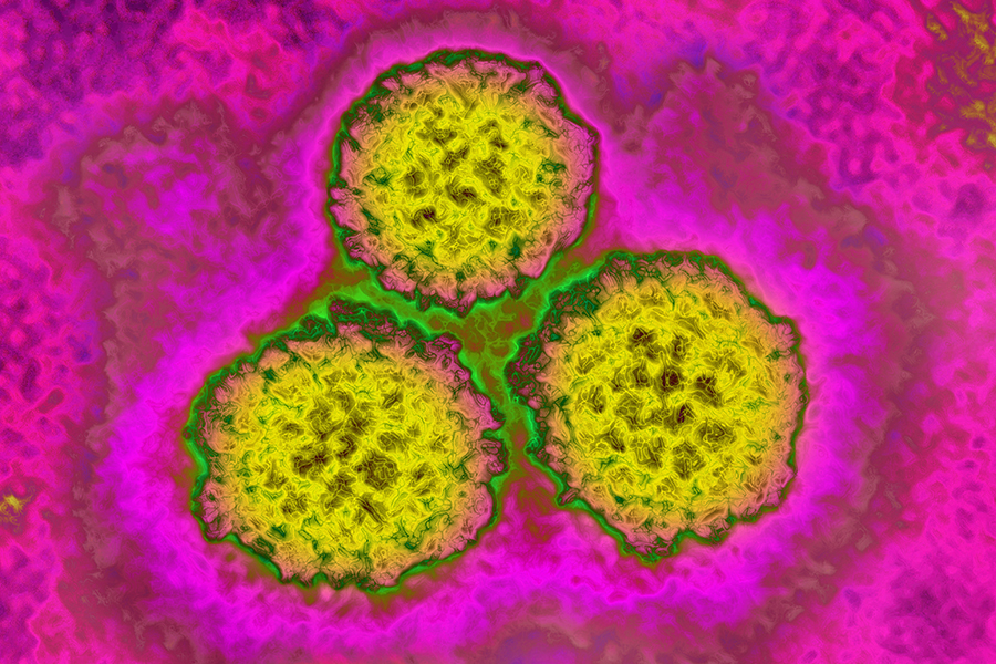 Papilloma virus, HPV). It causes cervical cancer. Image taken with transmission electron microscopy. (Photo by: BSIP/Universal Images Group via Getty Images)