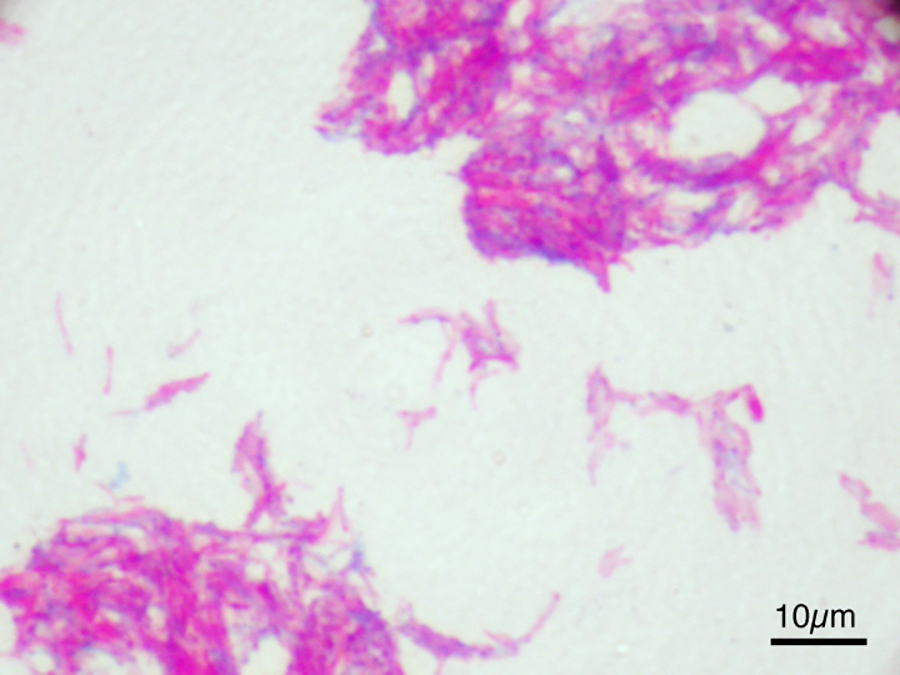 Imagine microscopică a bacilului Calmette–Guérin