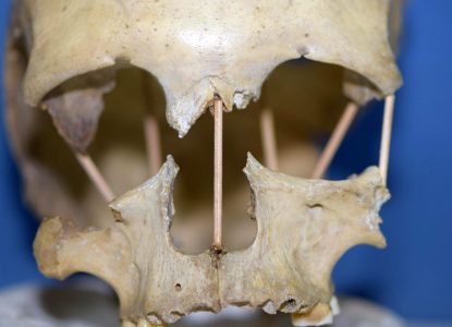 Ce dezvăluie craniul de 35.000 de ani din Peștera Muierii despre evoluția umană?
